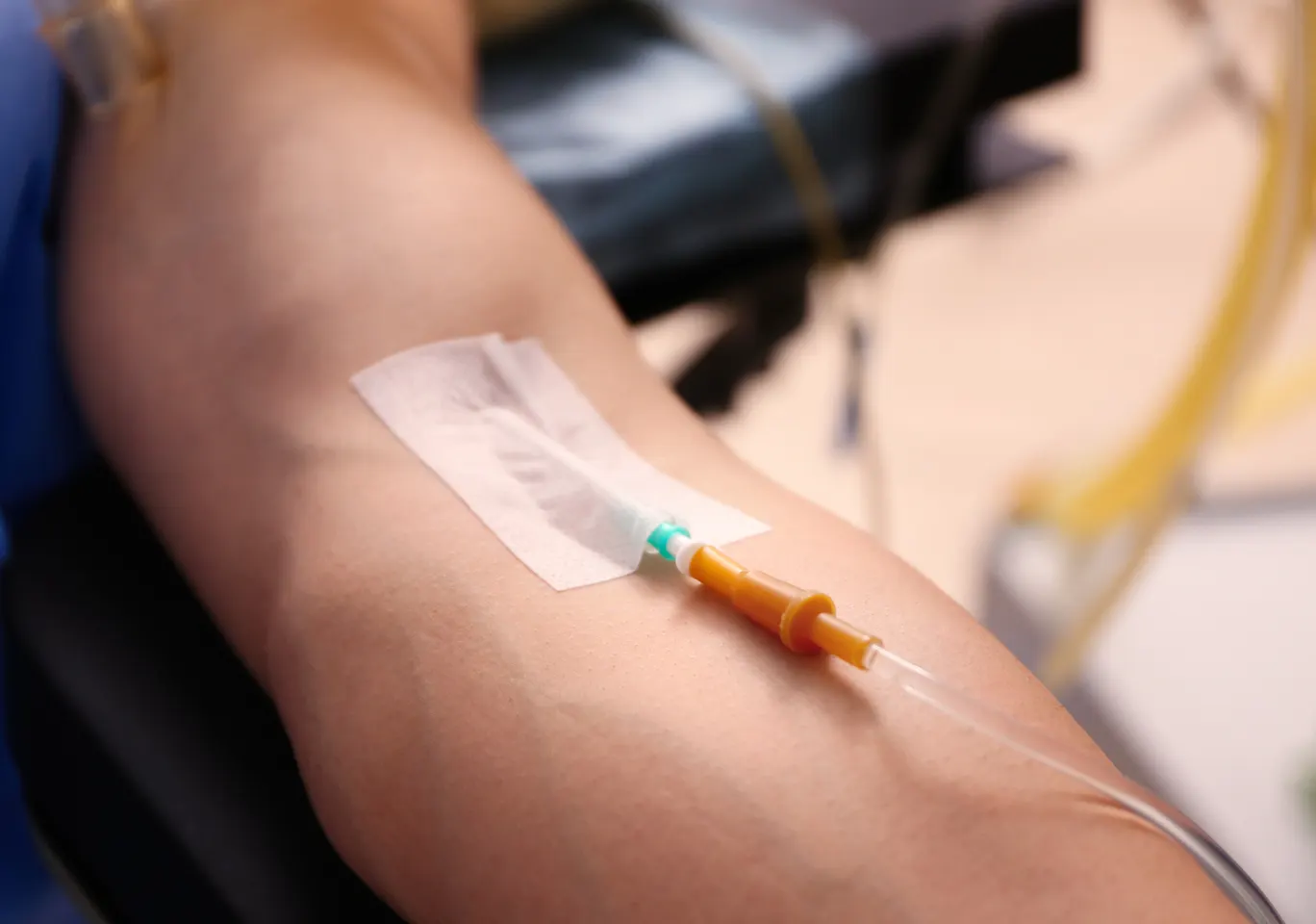 Kroplówki witaminowe Myślibórz: przedramię z kaniulą i przezroczystym opatrunkiem